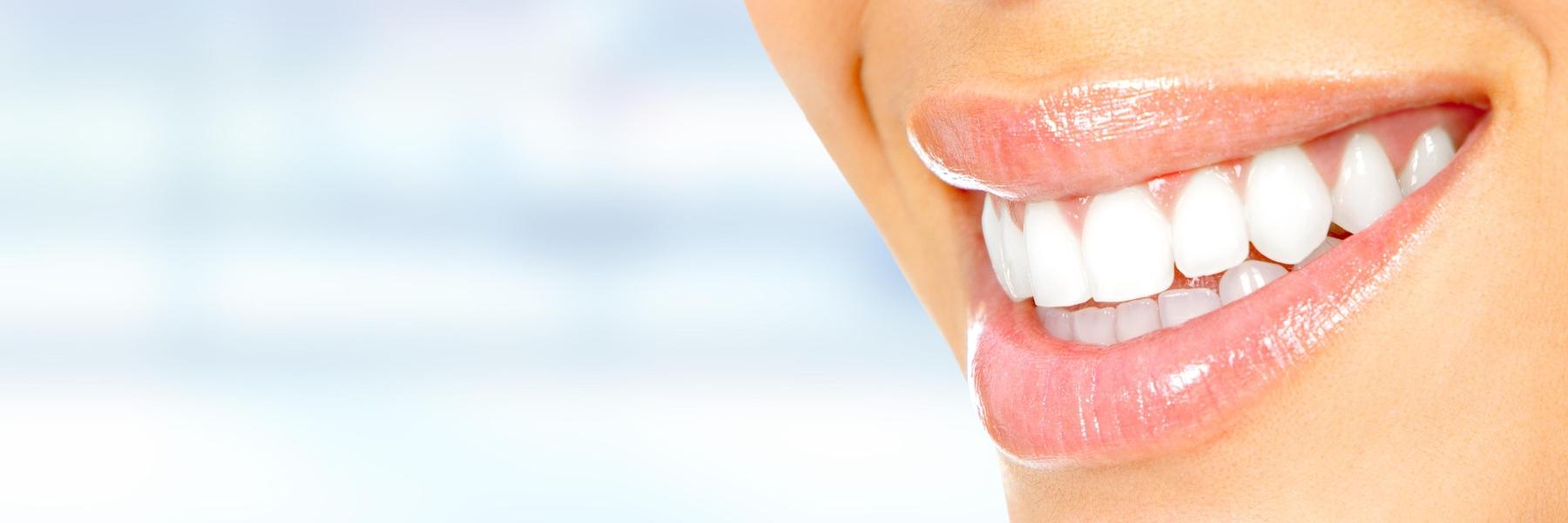 Brightened teeth in a smile 