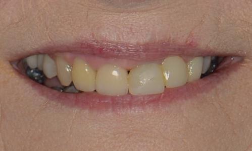 Cosmetic-Restoration-Before-Image