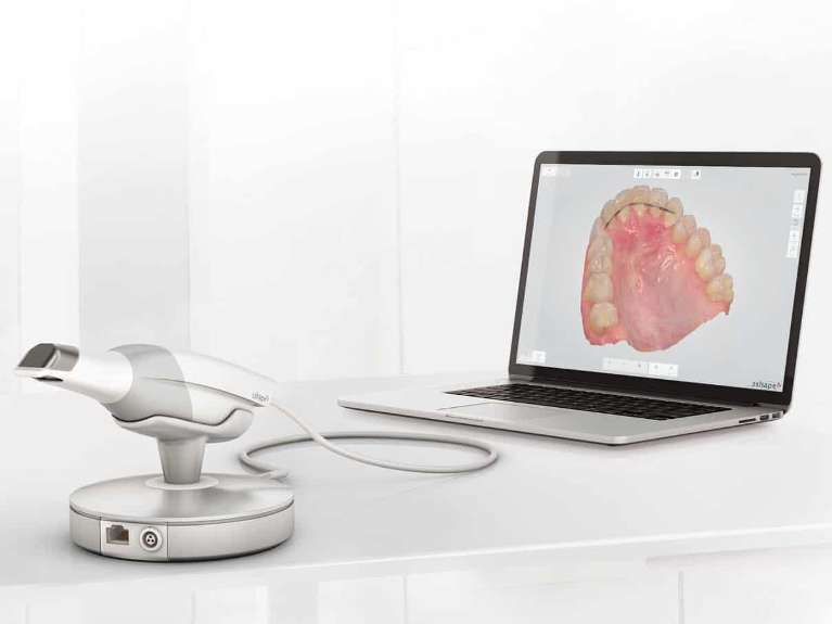 Trios scanner next to laptop with lower jaw image